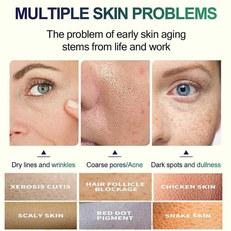 2ND Salicylic Acid Face Facial - Glycolic Acid Exfoliant recensione e prezzo