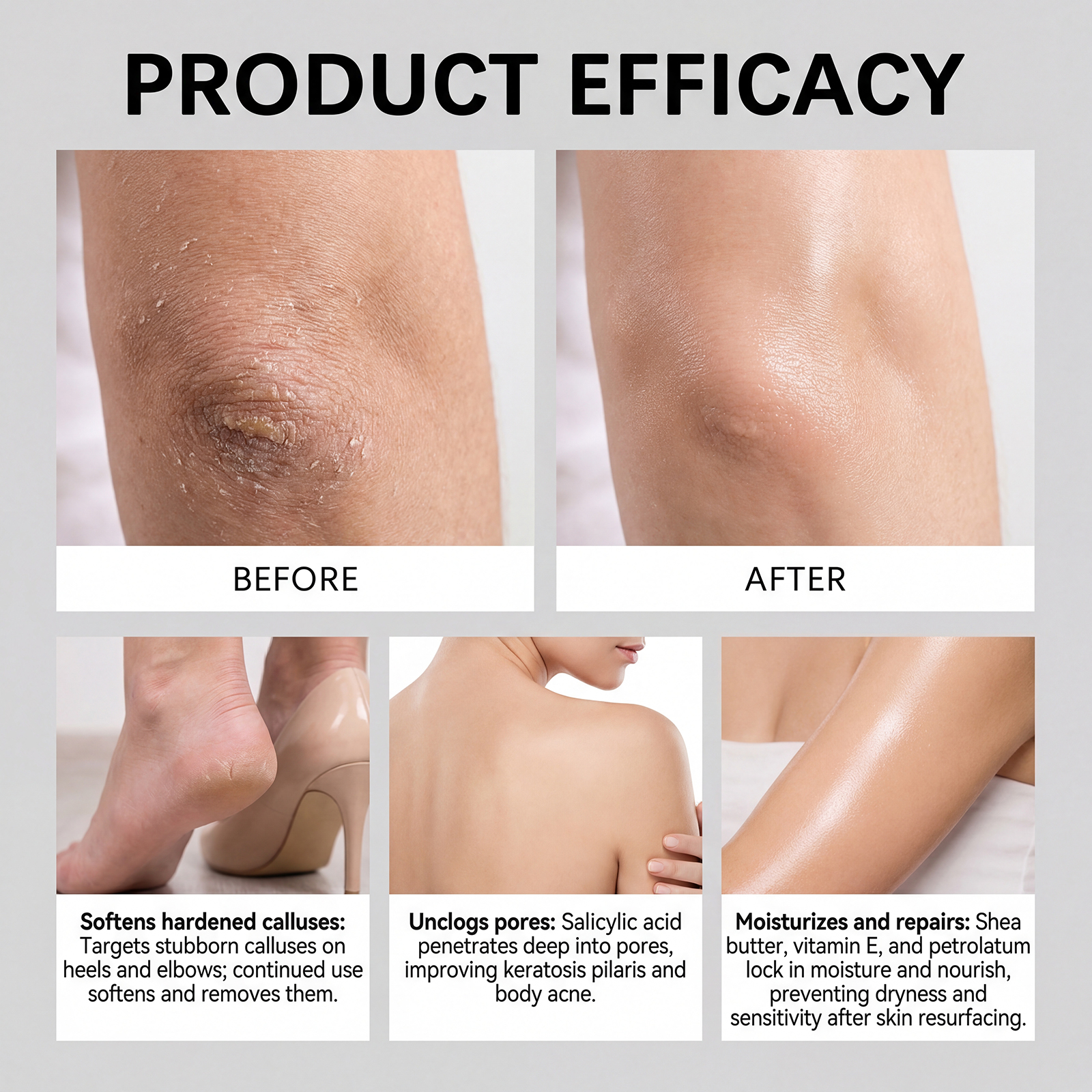 Exfoliating Body Stick Smoothi - Glycolic Acid Exfoliant recensione e prezzo